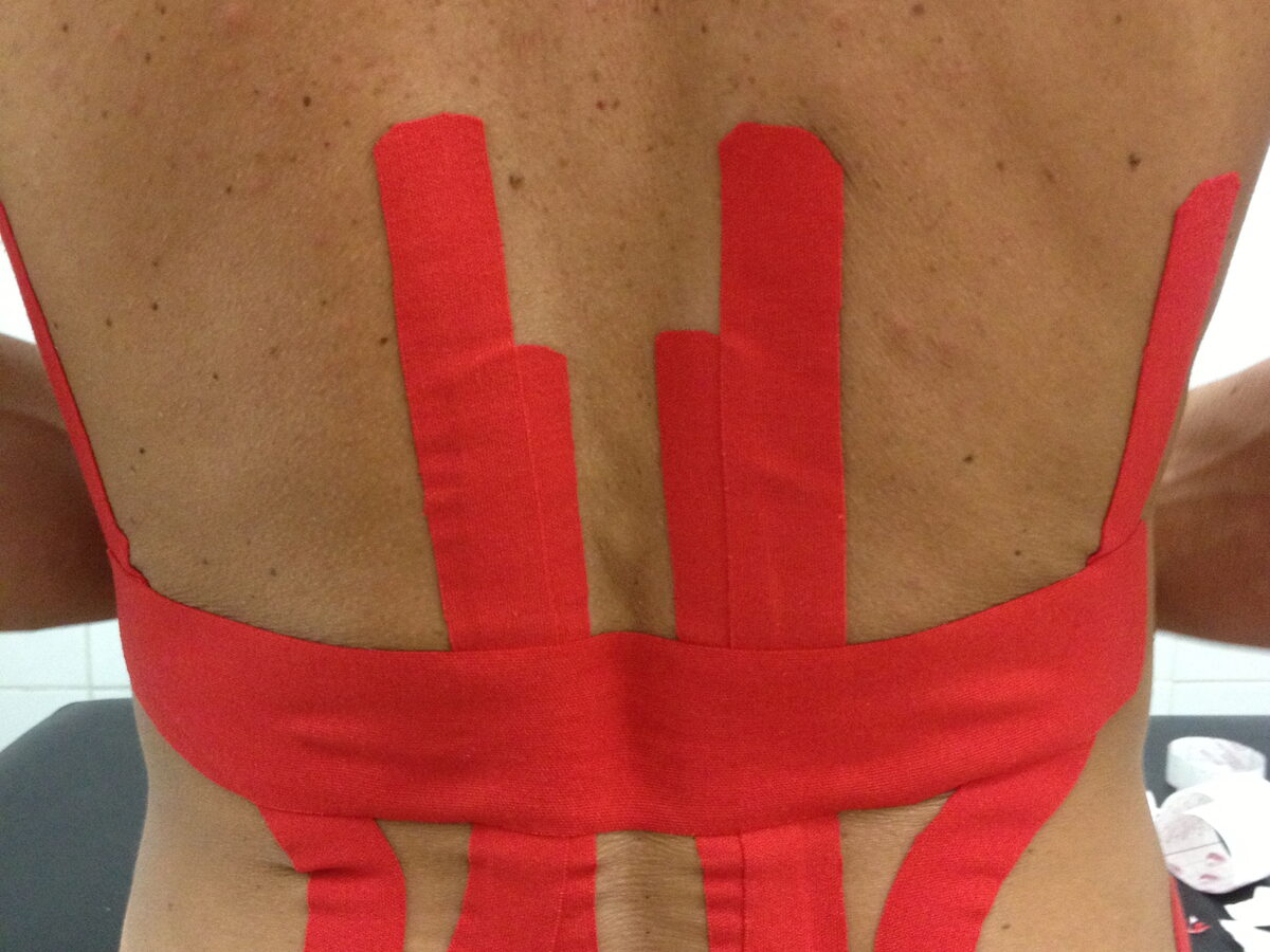 Applicazione di taping elastico sulla zona lombare